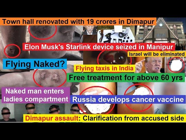 Nagamese Northeast Channel Evening News | 18 Dec'24 | Elon Musk's Starlink devices seized in Manipur