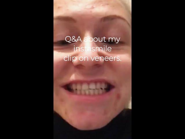 Jessica - Q&A about my instasmile clip on veneers