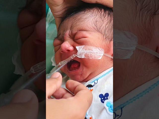 Nasogastric (NG) Tube Insertion in Neonate/Newborn | Orogastric (OG) Tube/Feeding Tube | Paediatric