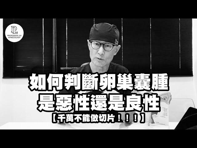 【EP81】如何判斷卵巢囊腫是惡性還是良性