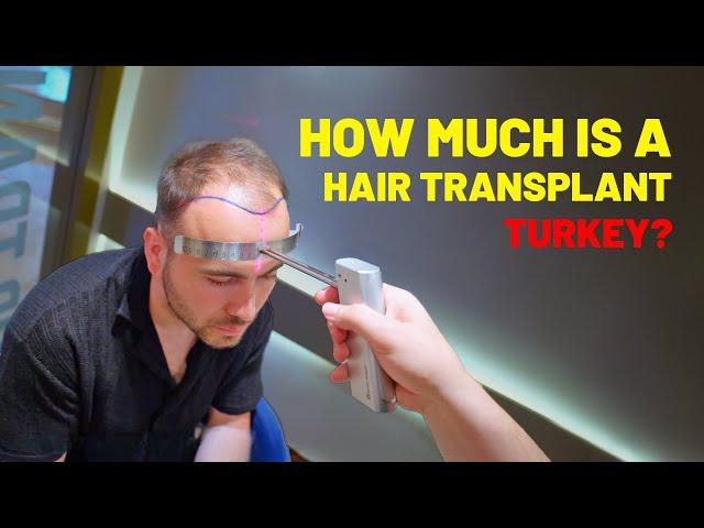 Hair Transplant Turkey - 2024