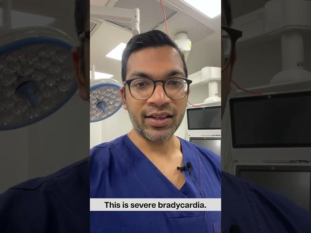 Diagonising Complete Heart Block | #shorts #ivcannulation #anesthesiology #nurse