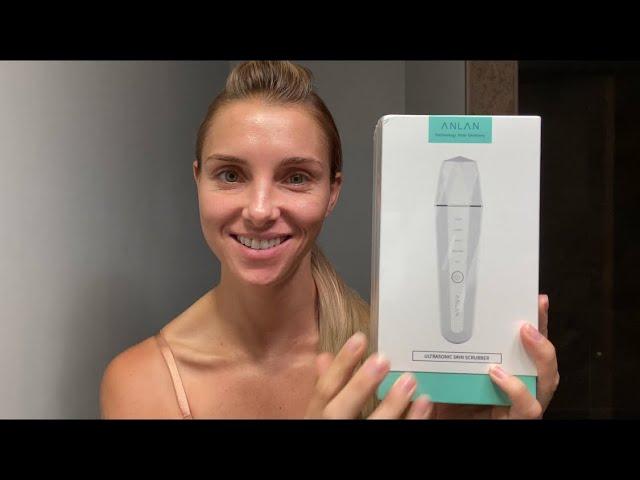 ANLAN WATERPROOF ULTRASONIC SKIN SCRUBBER // REVIEW