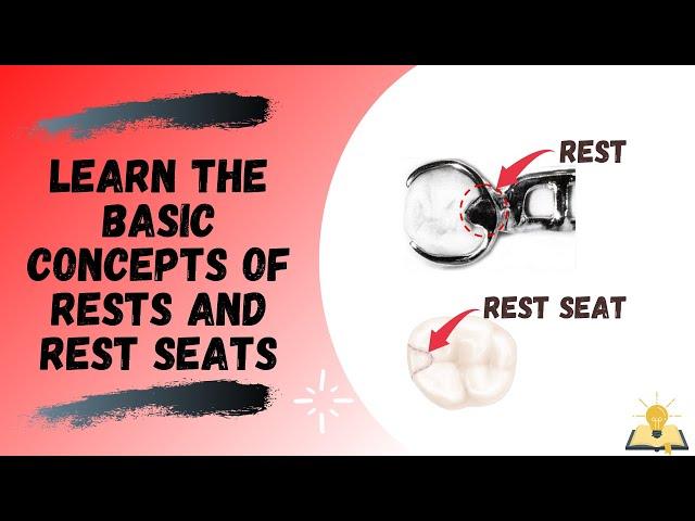 Rests and Rest Seats | The Basics | Removable Partial Denture (RPD)