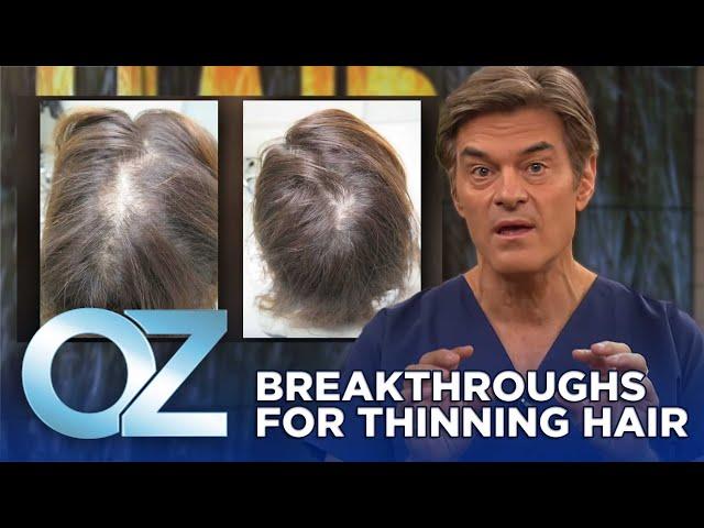 New Breakthroughs for Thinning Hair | Oz Health