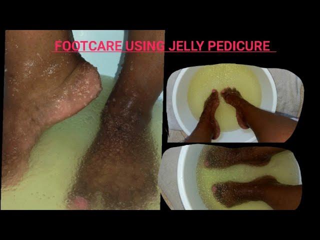 FOOT CARE TIPS AT HOME / USING JELLY PEDICURE TO PAMPER MY FEET AT HOME#pedicureathome #footcare