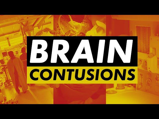 Contusion - traumatic brain injury explained