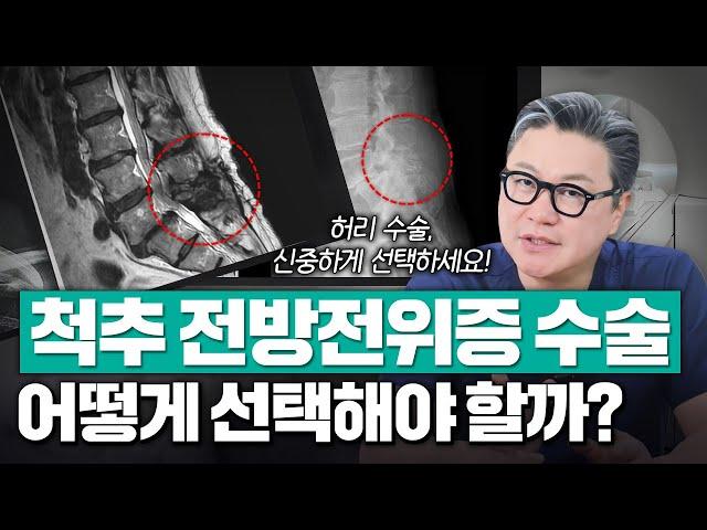 척추 전방전위증 수술, 어떻게 선택해야 할까? | 척추 MRI 소견 | 참포도나무병원 이동엽 원장