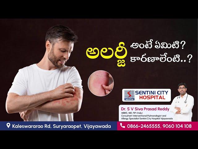 What are allergies? | What are the causes of allergies? | SENTINI CITY HOSPITAL | Vijayawada