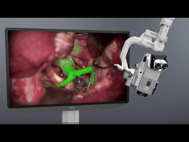 Surgical visualization solutions with Leica Microsystems