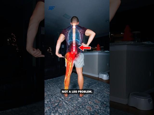 STOP Stretching Sciatica!