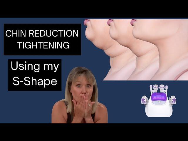 NON Surgical CHIN REDUCTION,  non Surgical neck lift using my S Shape.