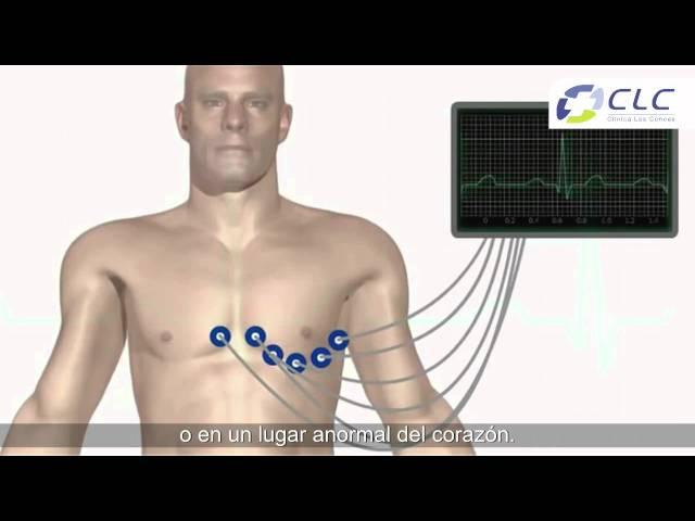 Procedimiento cardiología: Electrocardiograma [Clínica Las Condes]