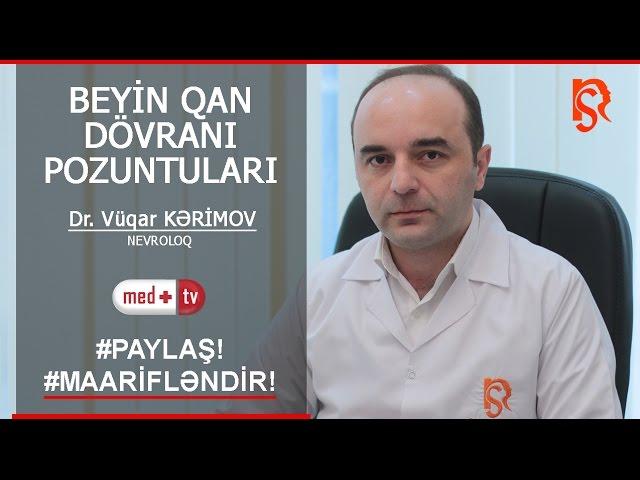 Beyin qan dovrani pozgunlugu - Hekim Nevroloq Vuqar Kerimov İstanbulNS