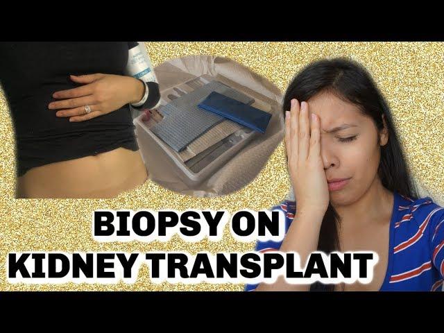 WHAT DOES A KIDNEY TRANSPLANT BIOPSY CONSIST OF! KIDNEY BIOPSY! 2 YEAR POST KIDNEY TRANSPLANT!