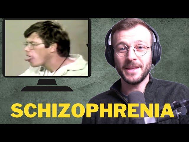 Schizophrenia & Dystonia (Incredible Archival Footage) | Dr Syl's Analysis