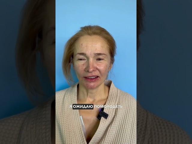 Омоложение лица + повторная риносептопластика