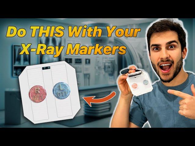 The BEST Way to Tape Your X-Ray Markers