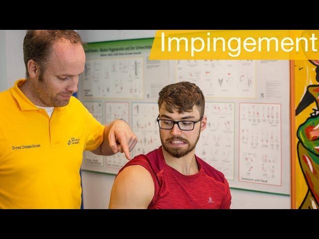 Impingement Syndrom Schulter ️Übungen | Ursachen | Test | Behandlung