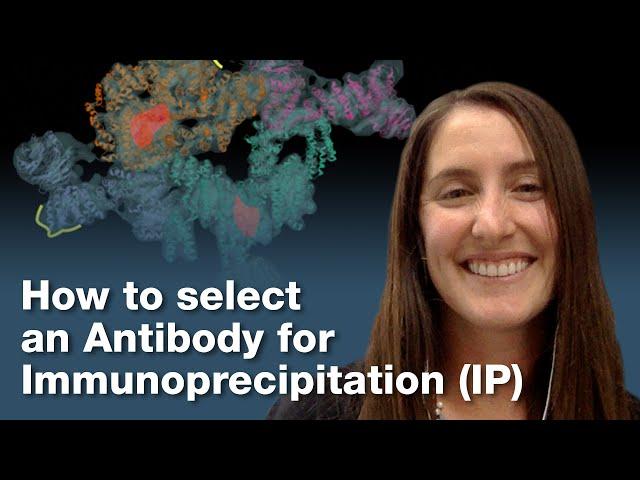 How to Select an Antibody for Protein Immunoprecipitation (IP) | CST Tech Tips
