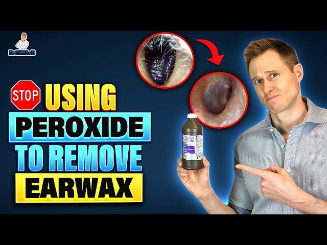 Stop Using Hydrogen Peroxide to remove Earwax!