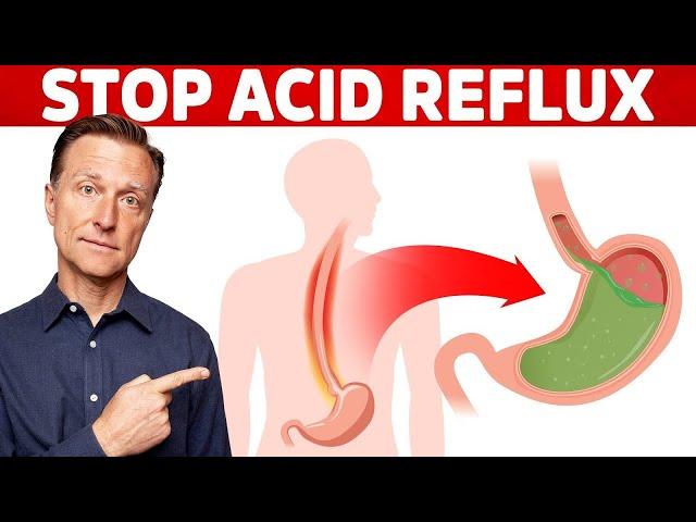 How to STOP Acid Reflux Instantly