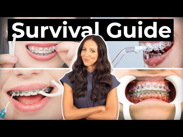 How To Prepare & What To Expect With BRACES