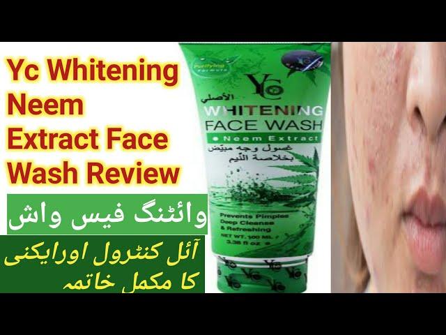 Yc Whitening Neem Extract Face Wash Review||face wash for acne||Herbal & beauty remedies