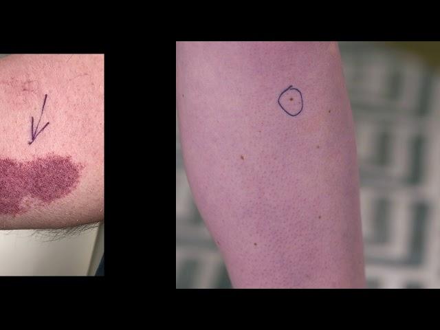 How to photograph your skin from home