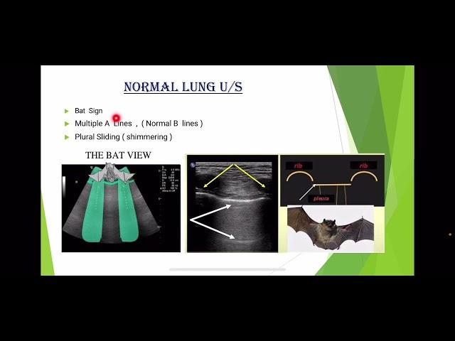 Chest  Ultrasonography Course , August  2022 ( part 1 )