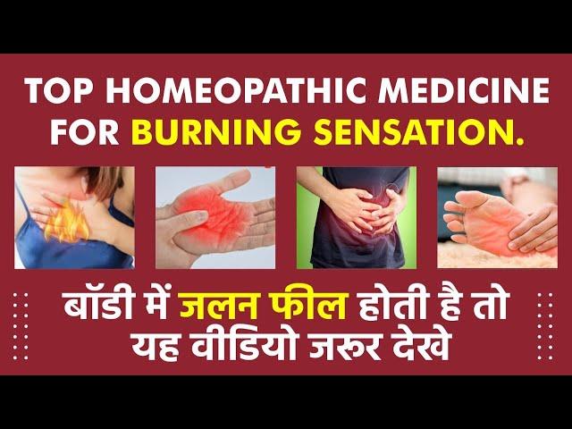 TOP HOMEOPATHIC MEDICINE FOR BURNING SENSATION | Dr. Kavita Soni | Soni Homeopathy clinic Bangalore