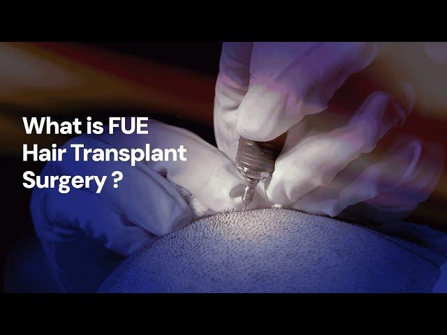 What is FUE Hair Transplant Surgery ?