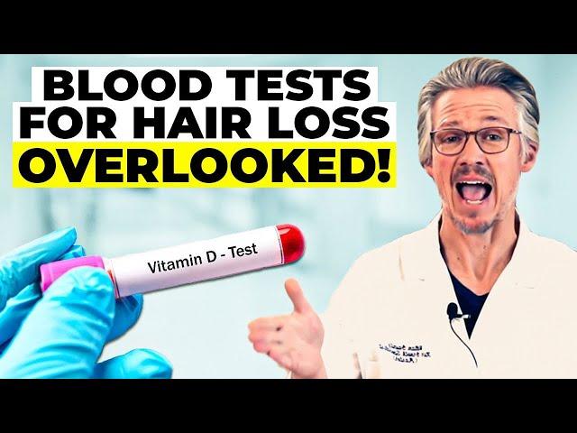 BLOOD TESTS FOR HAIR LOSS :THE CRITICAL BLOOD TESTS YOU NEED NOW!