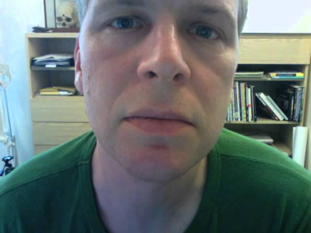 Bells Palsy Facial Twitching - My chin