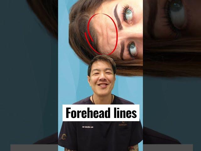 Can you get rid of forehead lines?