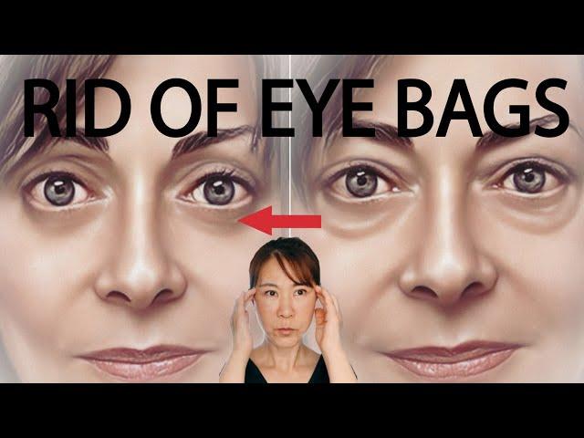 GET RID OF EYE BAGS FAST! Naturally at home. Why spend the $$?