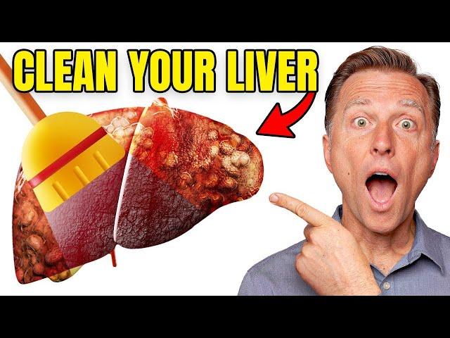 Top BEST Foods to Clean Out Your Liver