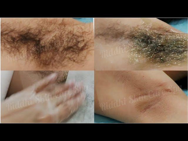 Underarms Waxing for Full Growth | Learn Waxing | Waxing Tutorial