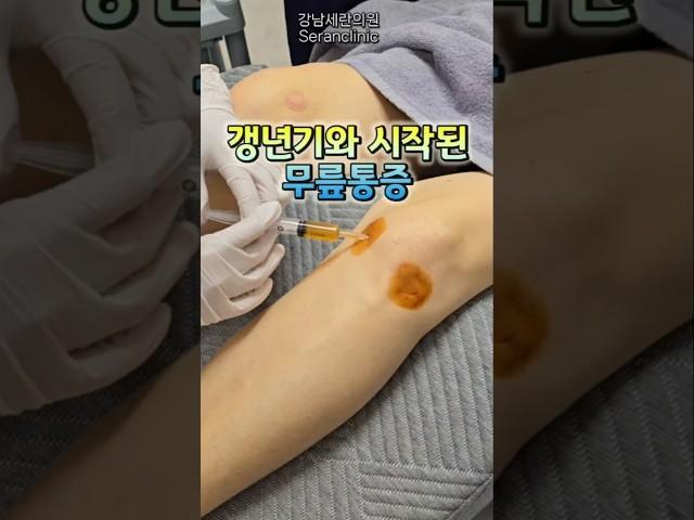 무릎통증과 갱년기 치료 진행 스토리 #무릎통증 #무릎퇴행성관절염 #무릎줄기세포치료 #갱년기