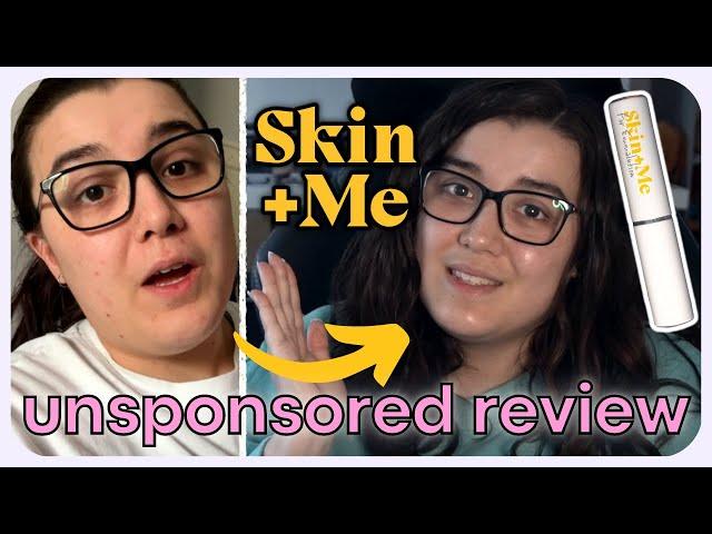 An honest and UNSPONSORED review of Skin+Me