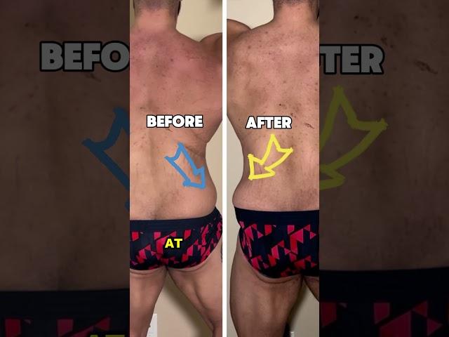 No more stretch marks ️