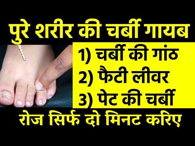 Amazing FINGER MASSAGE for lipoma, fat deposits under skin, fatty liver, obesity, weight loss /hindi