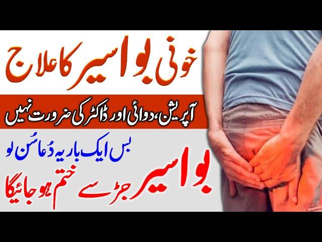 Bawaseer Ka Ilaj | Piles Treatment | Wazifa For Hamorrhoids | Qabz aur Bawaseer Ka Ilaj | Upedia