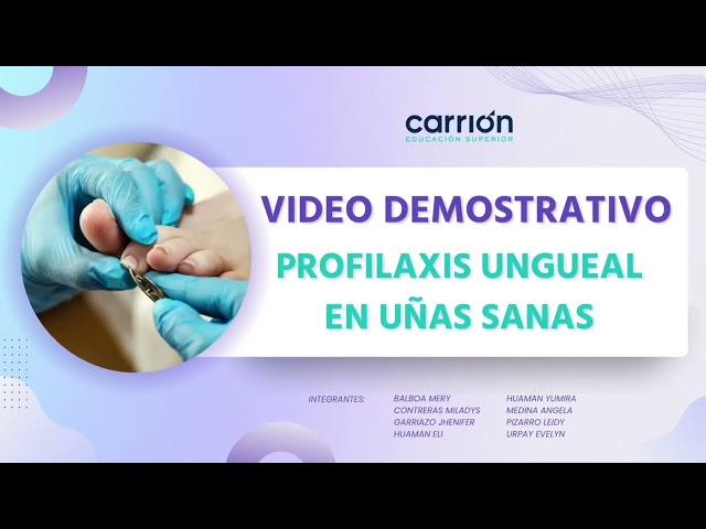 Video demostrativo de procedimiento de profilaxis ungueal en uñas sanas