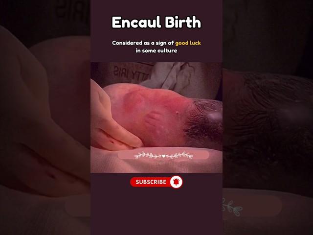 Amazing Baby in Amniotic Sac #pregnancy #fetus #subscribe