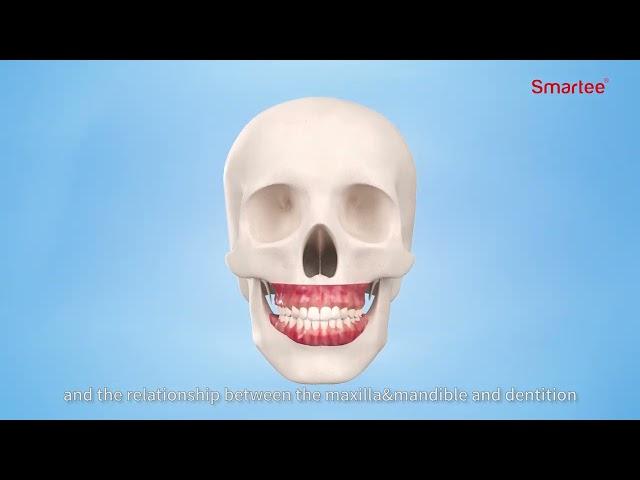 Smartee S17 --- Smartee Active Mandibular Repositioning Retention Protocol