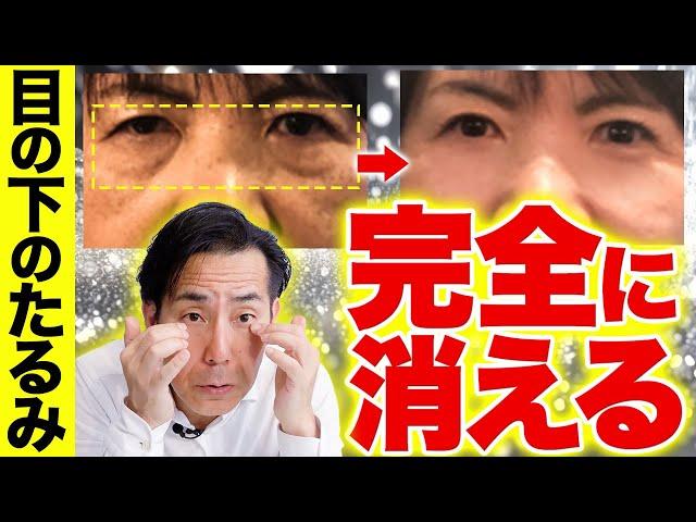 【老け顔の原因】目の下のぶよぶよを1分で完全に消す『眼輪筋ケア』【たるみ リンパケア】