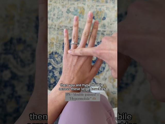 How to tell if you have double jointed fingers #eds #hypermobility #connectivetissuedisorder