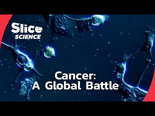 The War on Cancer: Challenges and Realities | SLICE SCIENCE | FULL DOC