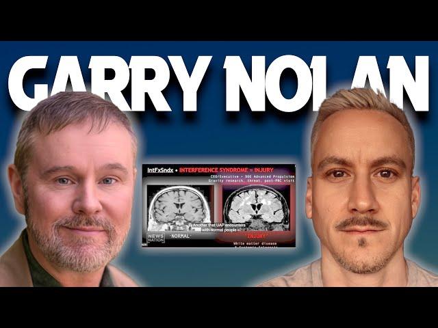 Presidential Disclosure, Medical Effects & More - Prof. Garry Nolan